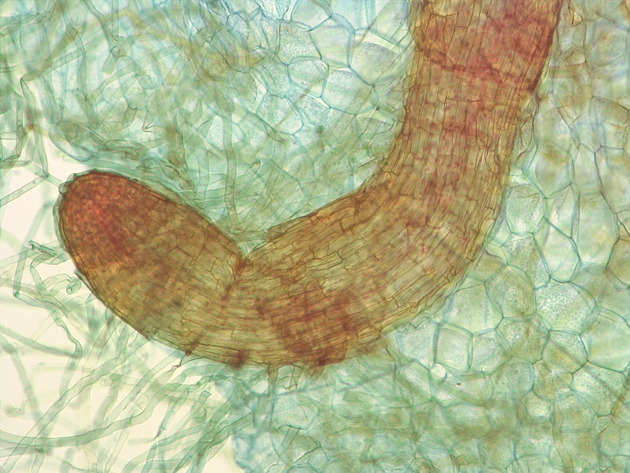 Fern Sporophyte Slides - Fernsporophyte 01 100X